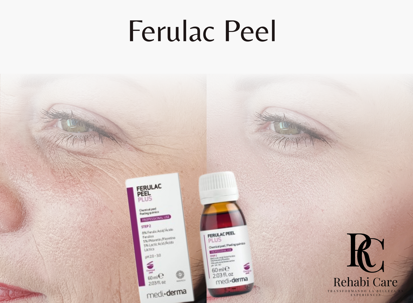 Ferulac Peel